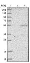 WD Repeat And SOCS Box Containing 1 antibody, NBP1-84162, Novus Biologicals, Western Blot image 