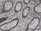 High Mobility Group 20A antibody, H00010363-M01, Novus Biologicals, Immunohistochemistry paraffin image 