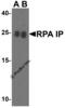 RPA Interacting Protein antibody, 4015, ProSci, Western Blot image 