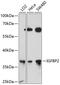 Insulin-like growth factor-binding protein 2 antibody, GTX64446, GeneTex, Western Blot image 