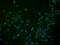 Multiple C2 And Transmembrane Domain Containing 2 antibody, NBP2-15020, Novus Biologicals, Immunocytochemistry image 