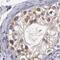Cysteinyl-TRNA Synthetase antibody, PA5-51709, Invitrogen Antibodies, Immunohistochemistry frozen image 