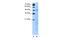 Solute Carrier Family 25 Member 46 antibody, A08250, Boster Biological Technology, Western Blot image 