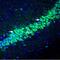 Potassium Voltage-Gated Channel Interacting Protein 2 antibody, PA5-77648, Invitrogen Antibodies, Immunohistochemistry paraffin image 