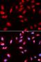 3-phosphoinositide-dependent protein kinase 1 antibody, LS-C331622, Lifespan Biosciences, Immunofluorescence image 