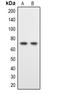 Dual specificity tyrosine-phosphorylation-regulated kinase 1B antibody, LS-C368859, Lifespan Biosciences, Western Blot image 