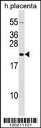 Growth Hormone 2 antibody, 58-499, ProSci, Western Blot image 