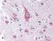Inducible T Cell Costimulator Ligand antibody, 49-249, ProSci, Immunohistochemistry paraffin image 