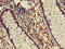 5-Aminoimidazole-4-Carboxamide Ribonucleotide Formyltransferase/IMP Cyclohydrolase antibody, orb21308, Biorbyt, Immunohistochemistry paraffin image 