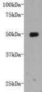LDL Receptor Related Protein 1 antibody, NBP2-66937, Novus Biologicals, Western Blot image 