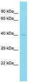 SAPCD2 antibody, TA331563, Origene, Western Blot image 