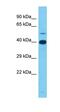 Serine protease 44 antibody, orb327092, Biorbyt, Western Blot image 