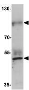 Prickle Planar Cell Polarity Protein 2 antibody, GTX31463, GeneTex, Western Blot image 