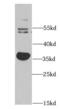 Aldo-Keto Reductase Family 1 Member C3 antibody, FNab00262, FineTest, Western Blot image 