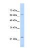 Troponin I1, Slow Skeletal Type antibody, NBP1-56642, Novus Biologicals, Western Blot image 