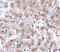 Actin Filament Associated Protein 1 Like 2 antibody, A03350, Boster Biological Technology, Immunohistochemistry paraffin image 