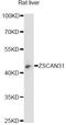 Zinc Finger And SCAN Domain Containing 31 antibody, LS-C749297, Lifespan Biosciences, Western Blot image 