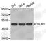 Filamin Binding LIM Protein 1 antibody, A4793, ABclonal Technology, Western Blot image 