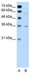 G Protein-Coupled Receptor Class C Group 5 Member A antibody, TA346102, Origene, Western Blot image 