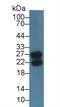 Immunoglobulin Lambda Like Polypeptide 1 antibody, LS-C722767, Lifespan Biosciences, Western Blot image 