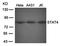 Signal Transducer And Activator Of Transcription 4 antibody, orb14460, Biorbyt, Western Blot image 