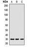 Exosome Component 3 antibody, LS-C668755, Lifespan Biosciences, Western Blot image 