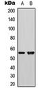 Polo Like Kinase 1 antibody, orb315655, Biorbyt, Western Blot image 