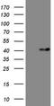 Myozenin 1 antibody, TA808907, Origene, Western Blot image 