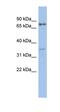 Eomesodermin homolog antibody, orb329999, Biorbyt, Western Blot image 