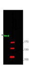 GLI2 antibody, A00701, Boster Biological Technology, Western Blot image 