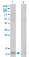 Heat Shock Protein Family E (Hsp10) Member 1 antibody, LS-C197470, Lifespan Biosciences, Western Blot image 