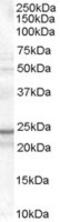 TIR Domain Containing Adaptor Protein antibody, MBS420184, MyBioSource, Western Blot image 