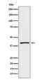 ATPase Na+/K+ Transporting Subunit Beta 3 antibody, M08492, Boster Biological Technology, Western Blot image 