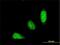 E3 ubiquitin-protein ligase TRIM31 antibody, H00011074-M03, Novus Biologicals, Immunocytochemistry image 