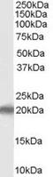 P53 Apoptosis Effector Related To PMP22 antibody, EB07234, Everest Biotech, Western Blot image 