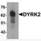 Dual specificity tyrosine-phosphorylation-regulated kinase 2 antibody, MBS150703, MyBioSource, Western Blot image 