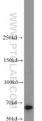 Insulin Like Growth Factor 2 MRNA Binding Protein 1 antibody, 22803-1-AP, Proteintech Group, Western Blot image 