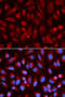 Adenosine Deaminase antibody, 13-487, ProSci, Immunofluorescence image 