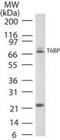 Tax1 Binding Protein 1 antibody, PA1-41176, Invitrogen Antibodies, Western Blot image 