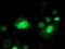 Serpin Family B Member 1 antibody, MA5-26361, Invitrogen Antibodies, Immunocytochemistry image 