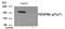 Platelet Derived Growth Factor Receptor Beta antibody, 79-959, ProSci, Western Blot image 