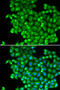 Lactate Dehydrogenase A antibody, STJ24386, St John