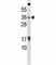 NK3 Homeobox 1 antibody, F45407-0.4ML, NSJ Bioreagents, Western Blot image 