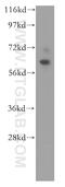 Debranching RNA Lariats 1 antibody, 16019-1-AP, Proteintech Group, Western Blot image 