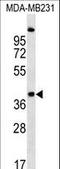 CCR4-NOT Transcription Complex Subunit 9 antibody, LS-C158897, Lifespan Biosciences, Western Blot image 