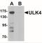 Unc-51 Like Kinase 4 antibody, NBP2-41244, Novus Biologicals, Western Blot image 