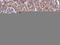 Insulin Like Growth Factor 2 antibody, LS-C311449, Lifespan Biosciences, Immunohistochemistry frozen image 