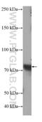 NaPi-2b antibody, 21295-1-AP, Proteintech Group, Western Blot image 