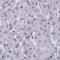 Semenogelin 1 antibody, PA5-59990, Invitrogen Antibodies, Immunohistochemistry paraffin image 