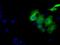 Sorbitol Dehydrogenase antibody, MA5-25017, Invitrogen Antibodies, Immunocytochemistry image 